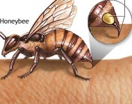 μέλισσα και δηλητήριο