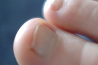 νύχια ποδιών