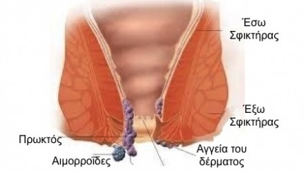 που βρίσκονται οι αιμορροΐδες